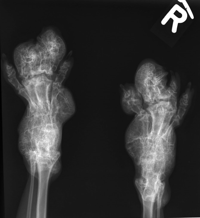 Das Röntgenbild der betroffenen Katze zeigt die Gelenksveränderungen